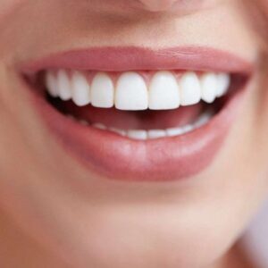 ¿Qué son los implantes dentales?