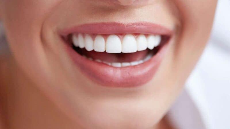 ¿Qué son los implantes dentales?