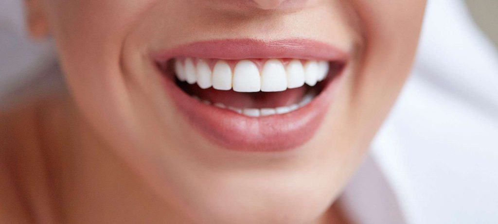 ¿Qué son los implantes dentales?